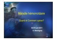 Maladie hémorroïdaire - chirurgie viscérale de l'ouest