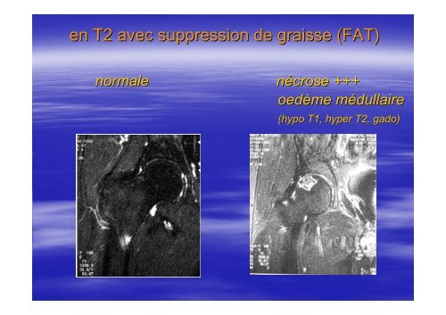 IMAGERIE et CLASSIFICATION. - GECO