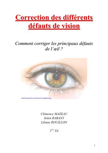 Correction des différents défauts de vision Comment corriger