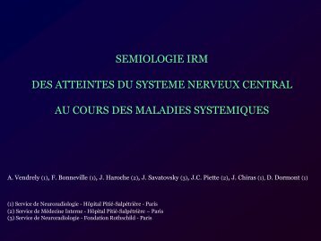 semiologie irm des atteintes du systeme nerveux central