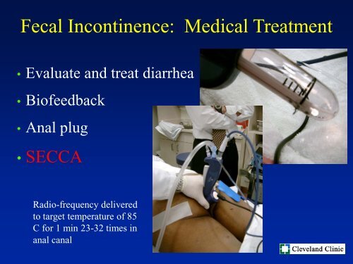 Keynote Lecture: Fecal Incontinence