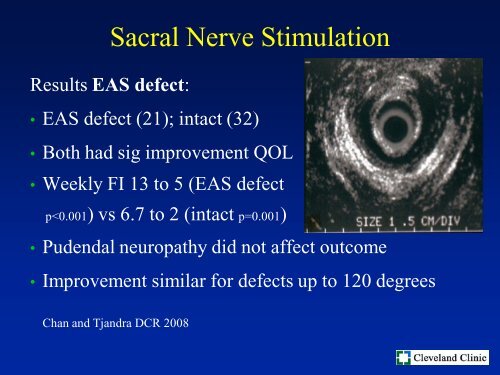 Keynote Lecture: Fecal Incontinence