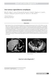 Quel est votre diagnostic ?