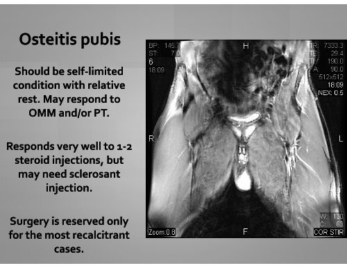 The Athletic Pelvis - American Academy of Osteopathy