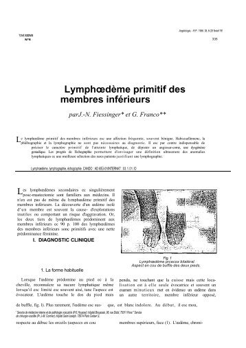 Lymphœdème primitif des membres inférieurs - Eureduc