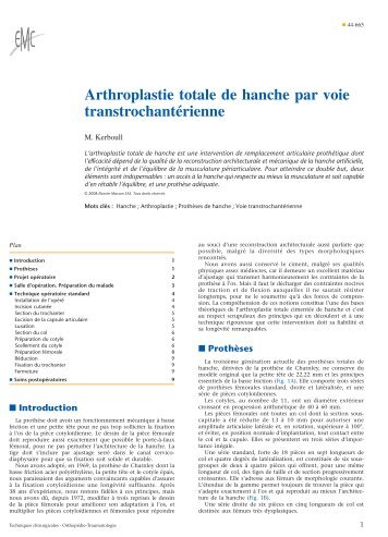 Arthroplastie totale de hanche par voie transtrochantérienne ...