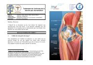 Traitement de l'arthrose de la hanche par réorientation - ICOS 13