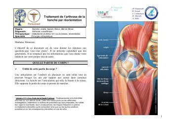 Traitement de l'arthrose de la hanche par réorientation - ICOS 13