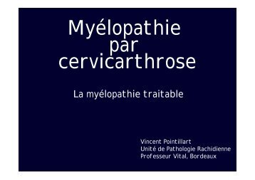 Myélopathie par cervicarthrose