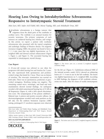 hearing loss with hydrocodone
