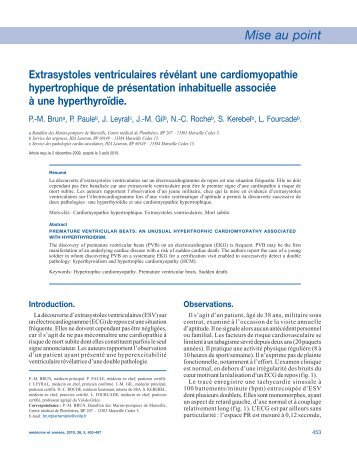 M. Extrasystoles ventriculaires révélant une cardiomyopathie ...