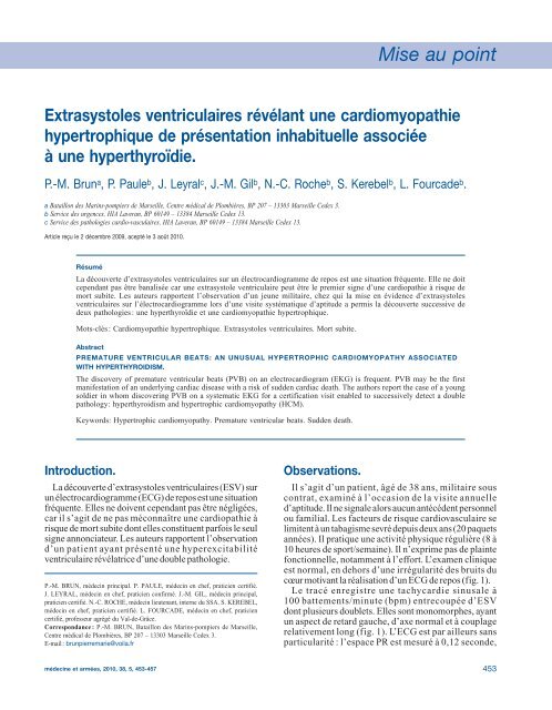 M. Extrasystoles ventriculaires révélant une cardiomyopathie ...