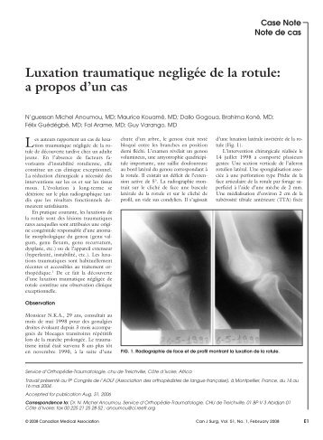 Luxation traumatique negligée de la rotule - Canadian Medical ...