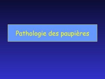 Pathologie des paupières