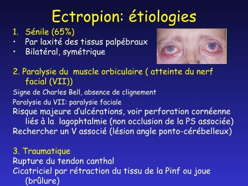 Pathologie des paupières