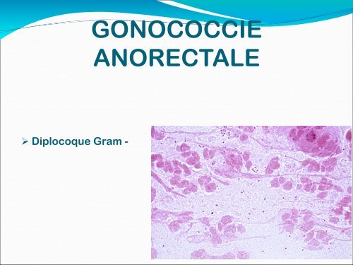 Gonococcie ano-rectale - Hepato Web