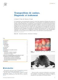 Transpositions de canines. Diagnostic et traitement - Belbacha Dental