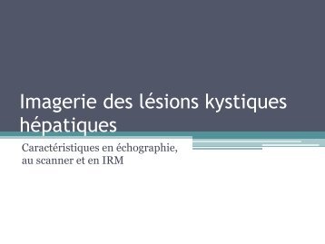 Imagerie des lésions kystiques hépatiques