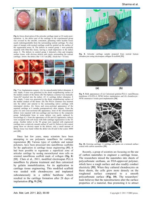 Cartilage tissue engineering: current scenario and challenges