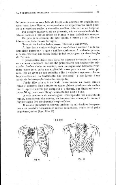 perturbações cárdio-Vasculares tuberculose pulmonar