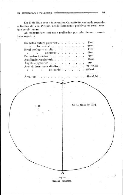 perturbações cárdio-Vasculares tuberculose pulmonar