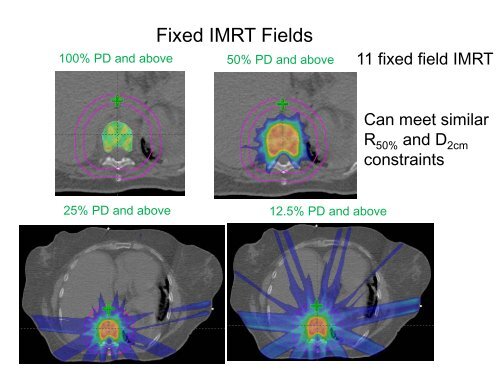 SBRT Treatment Planning: Practical Considerations