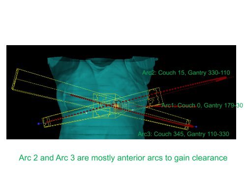 SBRT Treatment Planning: Practical Considerations