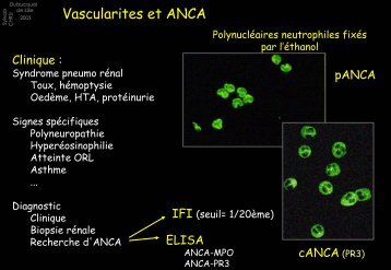 Prescrivez le bilan biologique standard.