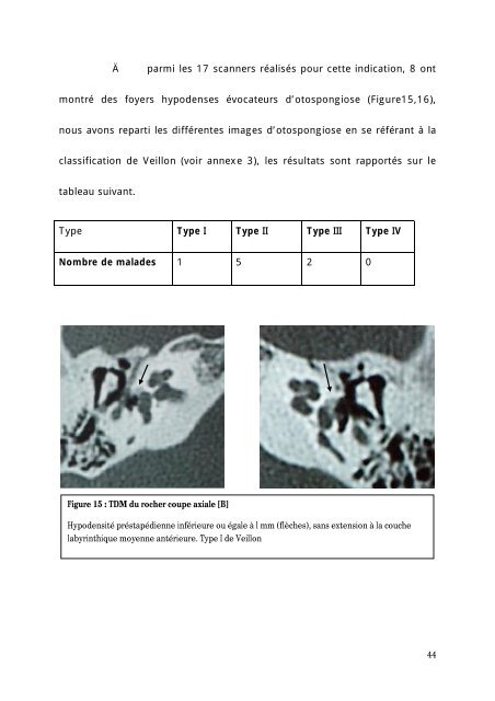 Graphique 1 - Faculté de Médecine et de Pharmacie de Fès