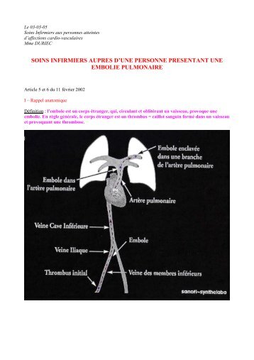 SOINS INFIRMIERS AUPRES D'UNE PERSONNE ... - Infirmiers.com