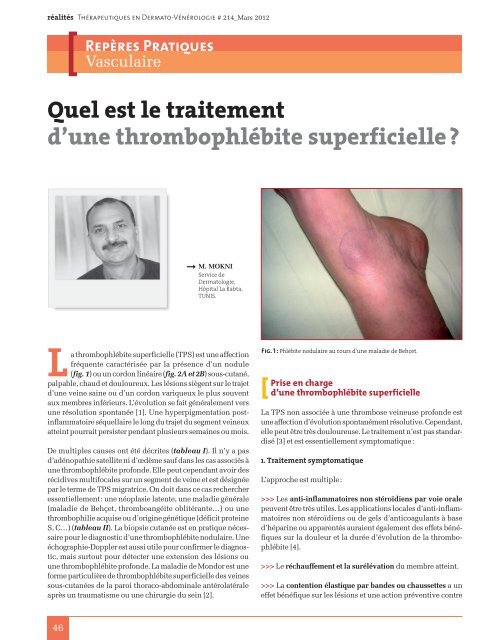Traitement phlébite local superficielle