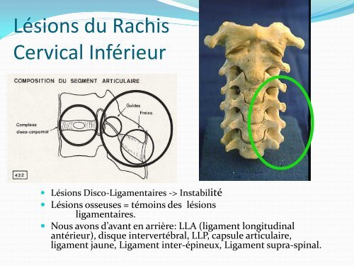 ENTORSE CERVICALE - amase