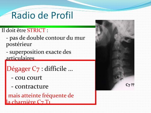 ENTORSE CERVICALE - amase