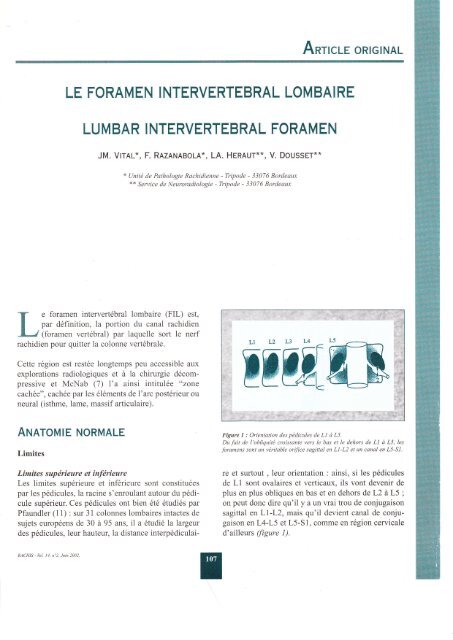 le foramen intervertebral lombaire - L'Institut de la Colonne Vertébrale