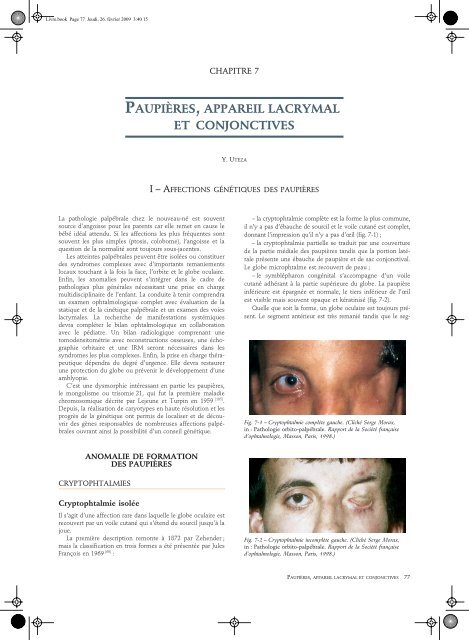 Lire l'Article - retinavisionetretinaaudition.fr