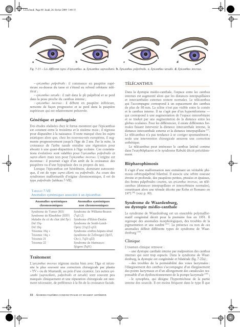 Lire l'Article - retinavisionetretinaaudition.fr