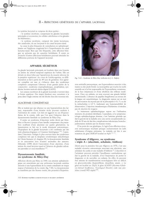 Lire l'Article - retinavisionetretinaaudition.fr