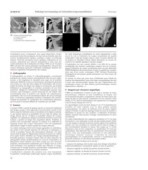 Pathologie non traumatique de l'articulation ... - Belbacha Dental