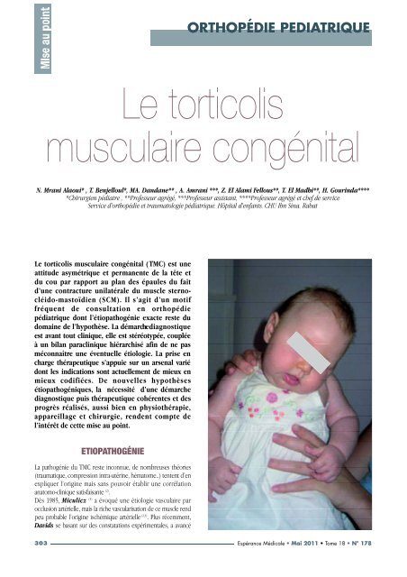 Le Torticolis Musculaire Congenital Pharmacies Ma