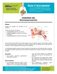 Mastotympanoplastie VF