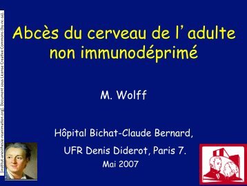 Abcès du cerveau de l'adulte non immunodéprimé