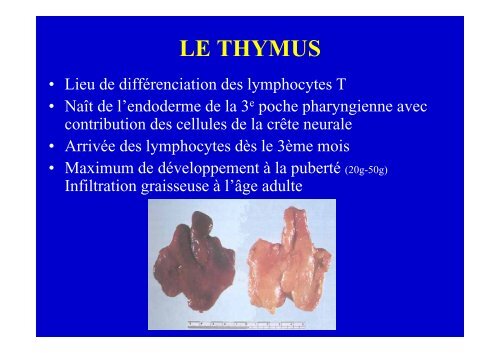 Lymphome Lymphoblastique T enfant et adulte