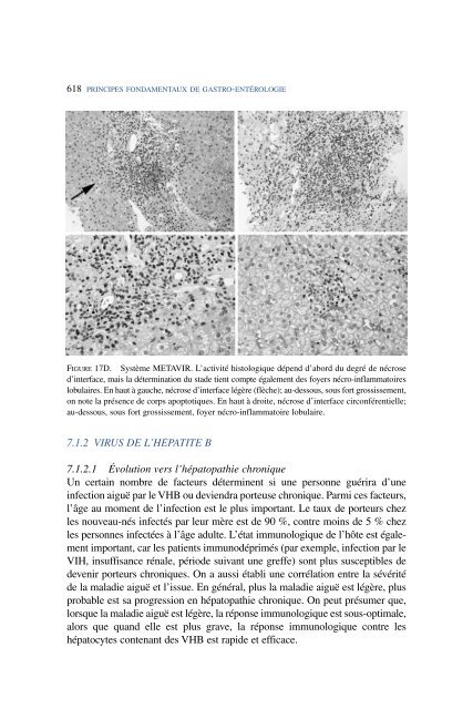 Untitled - The Canadian Association of Gastroenterology