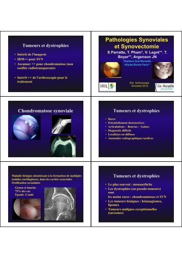 Pathologies Synoviales et Synovectomie