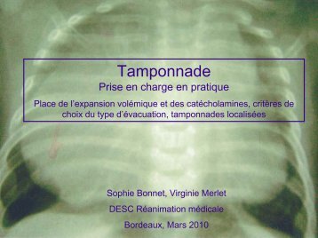 Tamponnade Prise en charge en pratique, place de l'expansion ...