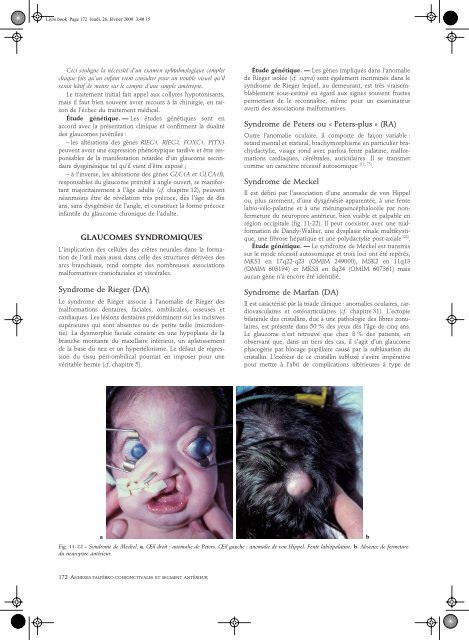 Lire l'Article - retinavisionetretinaaudition.fr