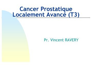 Cancer Prostatique Localement Avancé - Urobichat.fr