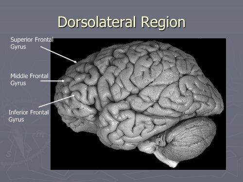 Frontal Lobe Syndromes & Disorders - Pgepsychiatry.com