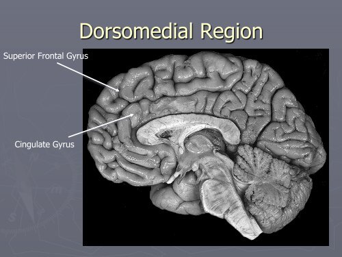 Frontal Lobe Syndromes & Disorders - Pgepsychiatry.com