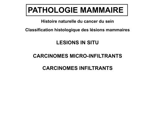 Carcinome canalaire in situ